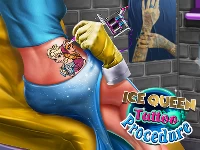 Ice queen tattoo procedure