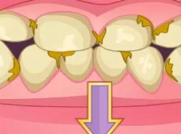 Bad teeth makeover